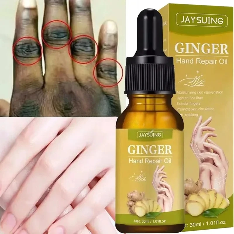 Dark Knuckles Fast Whitening Serum Brightening Pigmentation Correctors For Black Skin Intense Stains Remover Essence Products
Dark Knuckles Fast Whitening Serum Brightening Pigmentation Correctors For Black Skin Intense Stains Remover Essence Products