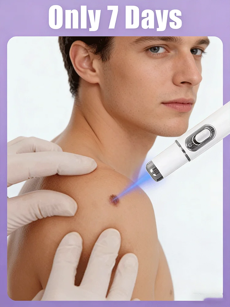 Лазерный прибор для удаления бородавок 3-го поколения 2026 года – избавление от всех бородавок за 7 дней
Лазерный прибор для удаления бородавок 3-го поколения 2026 года – избавление от всех бородавок за 7 дней