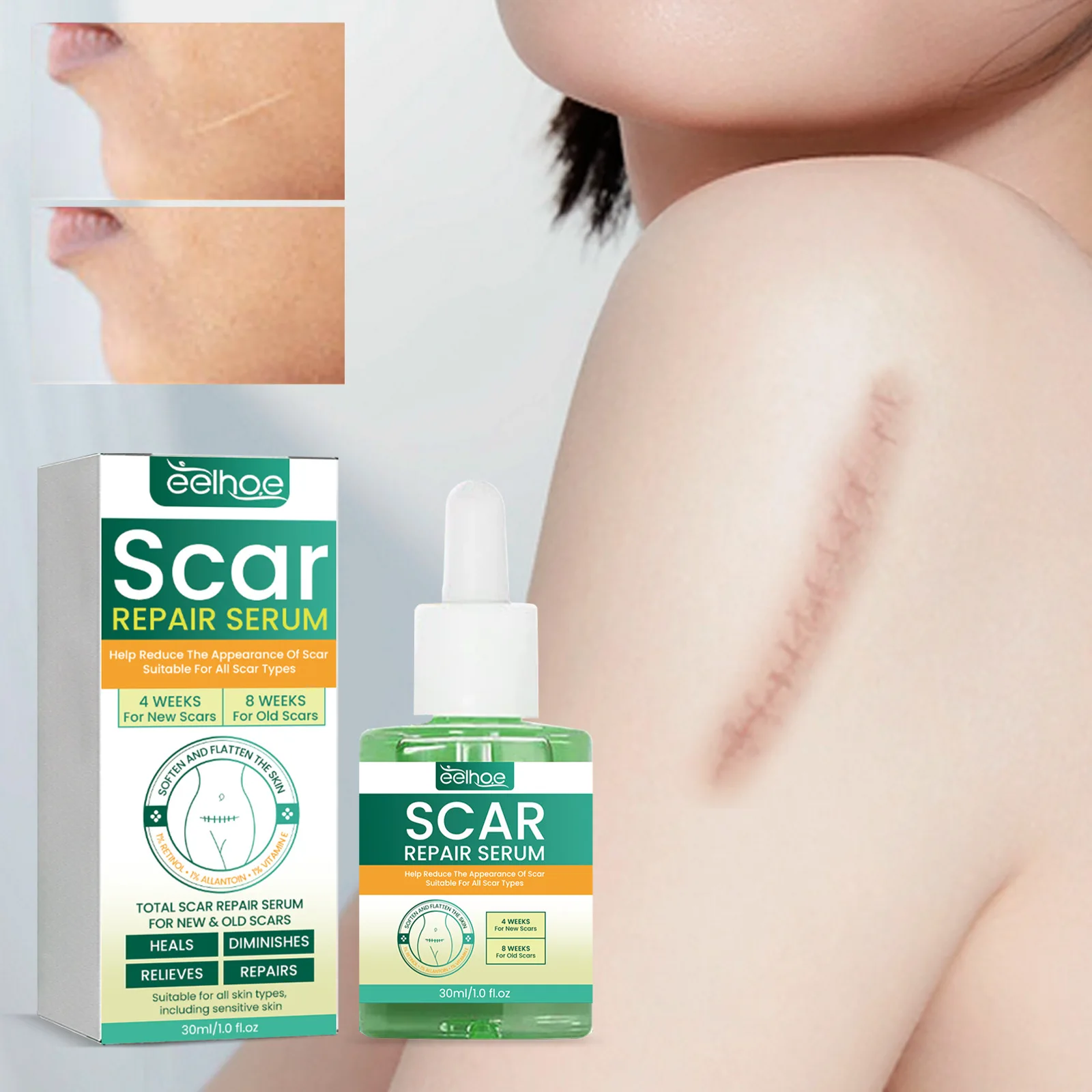 1 Bottle Scar Repair Essence To Fade Scar Pregnancy Scar Smoothing Skin Care Essence
1 Bottle Scar Repair Essence To Fade Scar Pregnancy Scar Smoothing Skin Care Essence