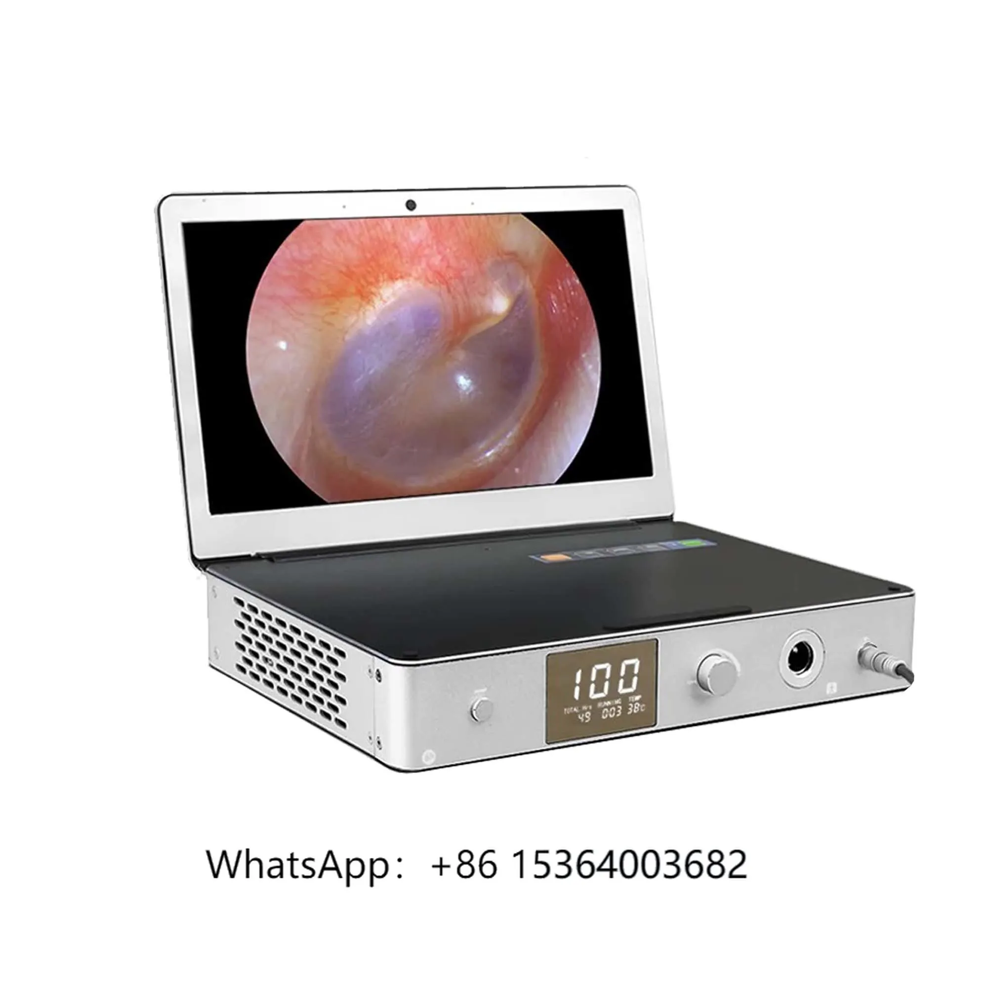 CE Mark All in One HD 11 Inches ENT Portable Medical Endoscope Endoscopic Camera System with Monitor
CE Mark All in One HD 11 Inches ENT Portable Medical Endoscope Endoscopic Camera System with Monitor
