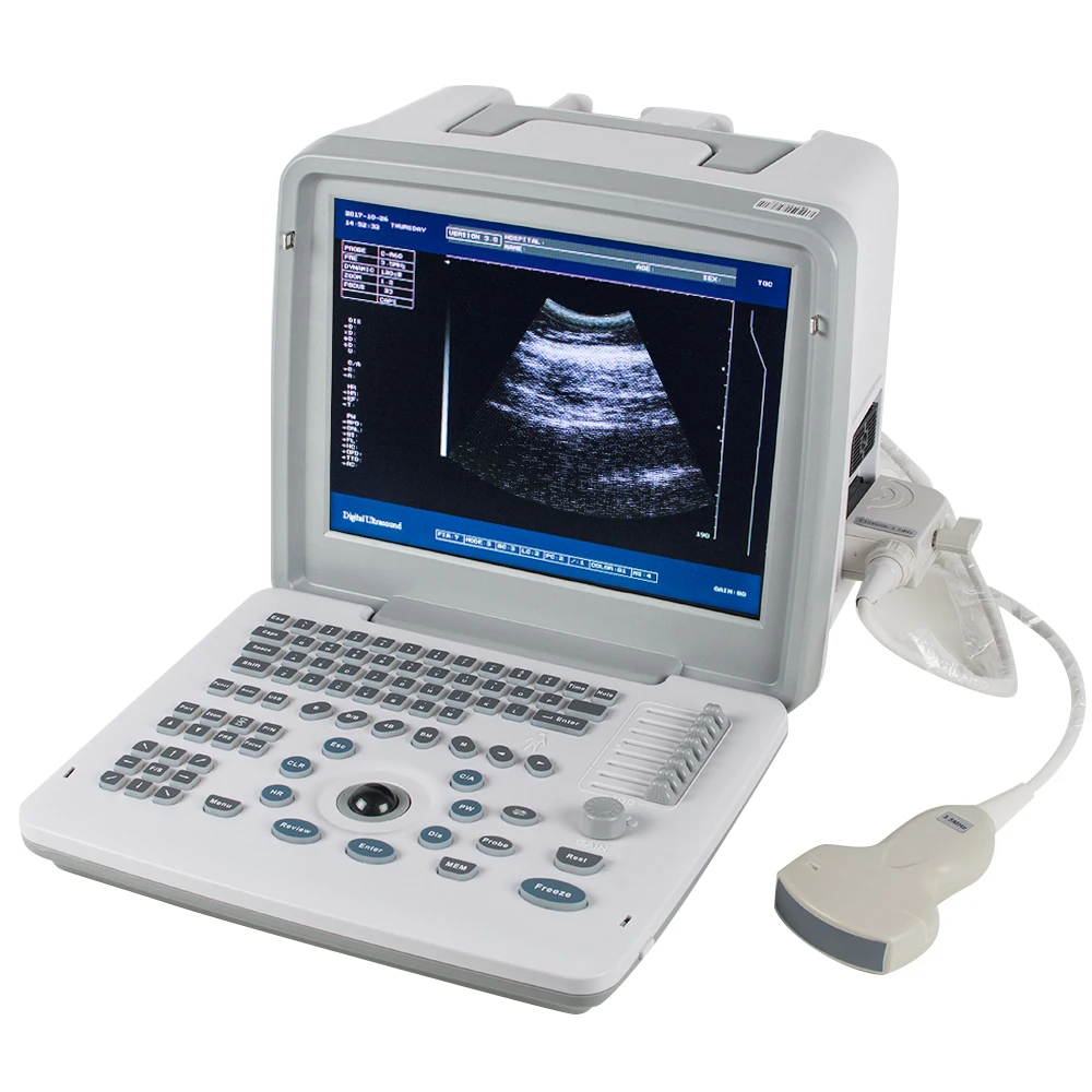 (Ship Today)Portable Ultrasound Scanner Monitor B-ultrasound USG Machine with multifunctional Convex Probe 3.5mhz for Pregnant
(Ship Today)Portable Ultrasound Scanner Monitor B-ultrasound USG Machine with multifunctional Convex Probe 3.5mhz for Pregnant