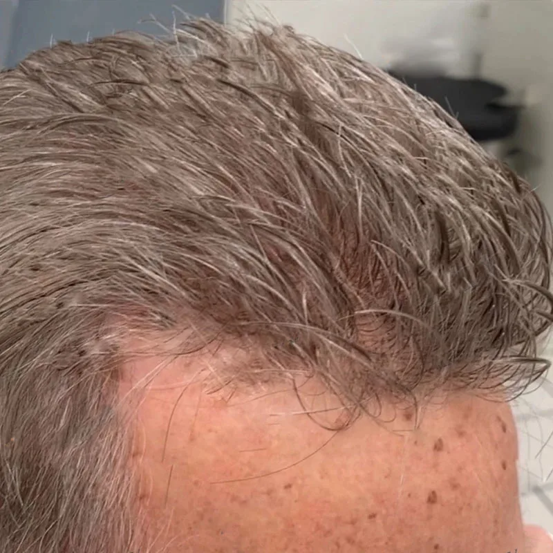 Натуральная линия волос 0,02 мм, супер тонкая кожа, коричневый, черный, мужской парик 80 ~ 90%, плотность, серый, мужской 1B80 # Капиллярные протезы из человеческих волос 410
Натуральная линия волос 0,02 мм, супер тонкая кожа, коричневый, черный, мужской парик 80 ~ 90%, плотность, серый, мужской 1B80 # Капиллярные протезы из человеческих волос 410