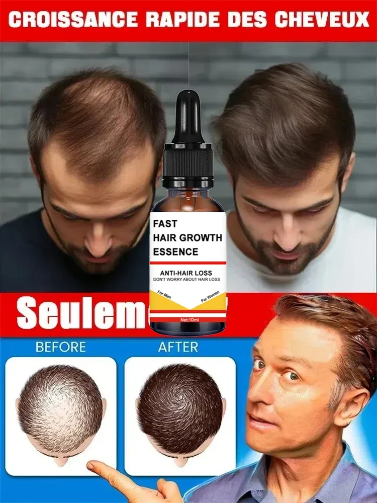 Say goodbye to baldness and have thicker hair
Say goodbye to baldness and have thicker hair