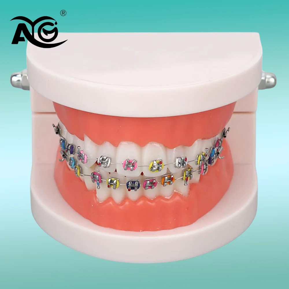 AG Стоматологическая ортодонтическая модель зубов с красочными брекетами, профессиональная модель рта для протезов, демонстрационный учебный инструмент для стоматологии
AG Стоматологическая ортодонтическая модель зубов с красочными брекетами, профессиональная модель рта для протезов, демонстрационный учебный инструмент для стоматологии
