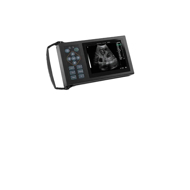 Veterinary Instrument Handle B-ultrasound Machine For Animals Hospital Equipment Medical Equipment Concentrator
Veterinary Instrument Handle B-ultrasound Machine For Animals Hospital Equipment Medical Equipment Concentrator