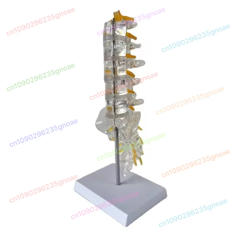 Transparent 3D Lumbar Spine Model with Tailbone - Shows Intervertebral Disc, Spinal Nerve & Sacrum (Orthopedic Teaching Tool)
Transparent 3D Lumbar Spine Model with Tailbone - Shows Intervertebral Disc, Spinal Nerve & Sacrum (Orthopedic Teaching Tool)