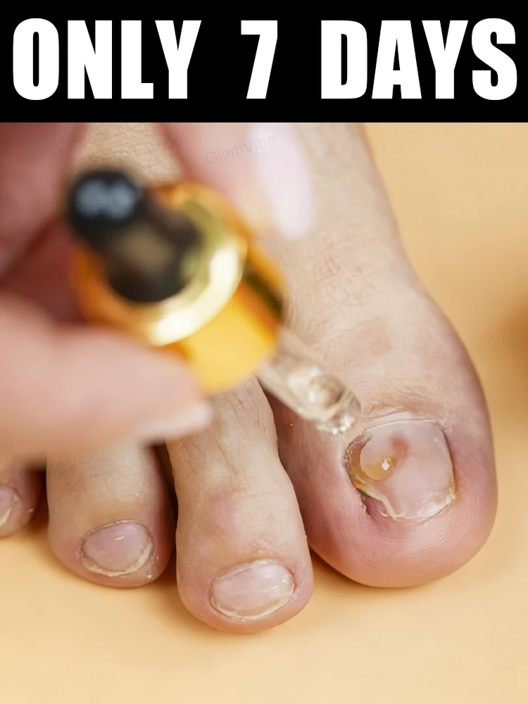 Technology changes life and says goodbye to onychomycosis
Technology changes life and says goodbye to onychomycosis