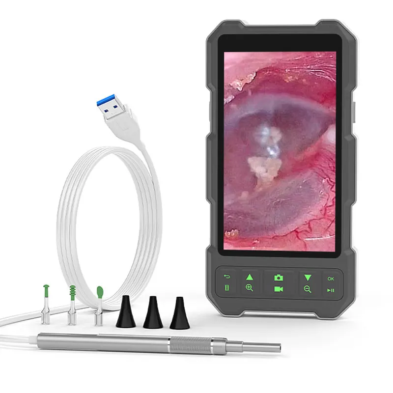 Digital Ear Camera 4.5''IPS Screen HD1080P 3.9MM Ear Picker Video Ear Spoons 6LEDs Ear Wax Removal Tool Visual Ear Cleaner Stick
Digital Ear Camera 4.5''IPS Screen HD1080P 3.9MM Ear Picker Video Ear Spoons 6LEDs Ear Wax Removal Tool Visual Ear Cleaner Stick