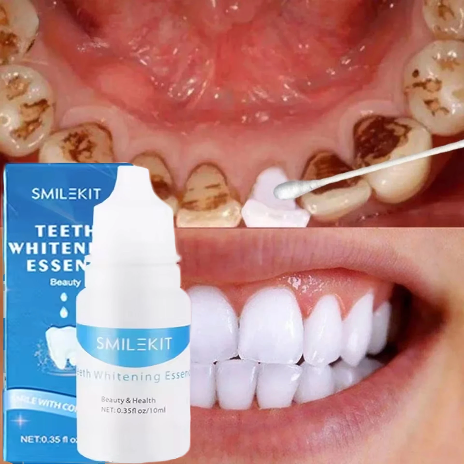 Teeth Whitening Serum Remove Stains Smoke Coffee Plaque Deep Cleaning Dental Oral Hygiene Fresh Breath Tooth Care Products
Teeth Whitening Serum Remove Stains Smoke Coffee Plaque Deep Cleaning Dental Oral Hygiene Fresh Breath Tooth Care Products