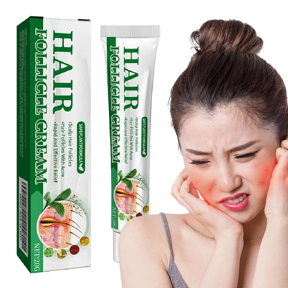 Herbal Acne Treatment Anti-Acne Cream Improves Redness Acne Cosmetics Repair Scar Care Gel Face Skin Blackhead Korean Remov Y7A0
Herbal Acne Treatment Anti-Acne Cream Improves Redness Acne Cosmetics Repair Scar Care Gel Face Skin Blackhead Korean Remov Y7A0