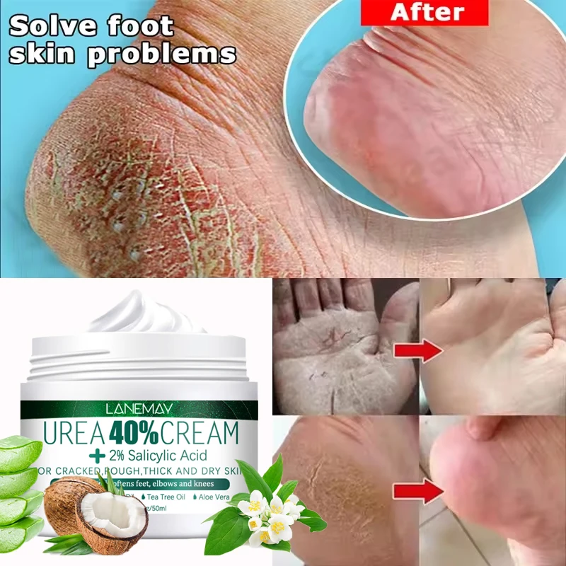 Herbal Anti Crack Foot Cream Heel Cracking Repair Products Exfoliation Dead Skin Removal Softening Moisturizing Hand Feet Care
Herbal Anti Crack Foot Cream Heel Cracking Repair Products Exfoliation Dead Skin Removal Softening Moisturizing Hand Feet Care