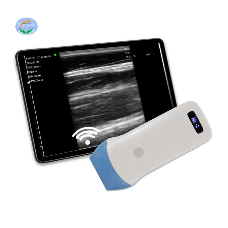 Беспроводной ультразвуковой датчик Clarius 14 МГц беспроводной ультразвуковой сканер линейный датчик 128 элементов беспроводной ультразвуковой сканер
Беспроводной ультразвуковой датчик Clarius 14 МГц беспроводной ультразвуковой сканер линейный датчик 128 элементов беспроводной ультразвуковой сканер