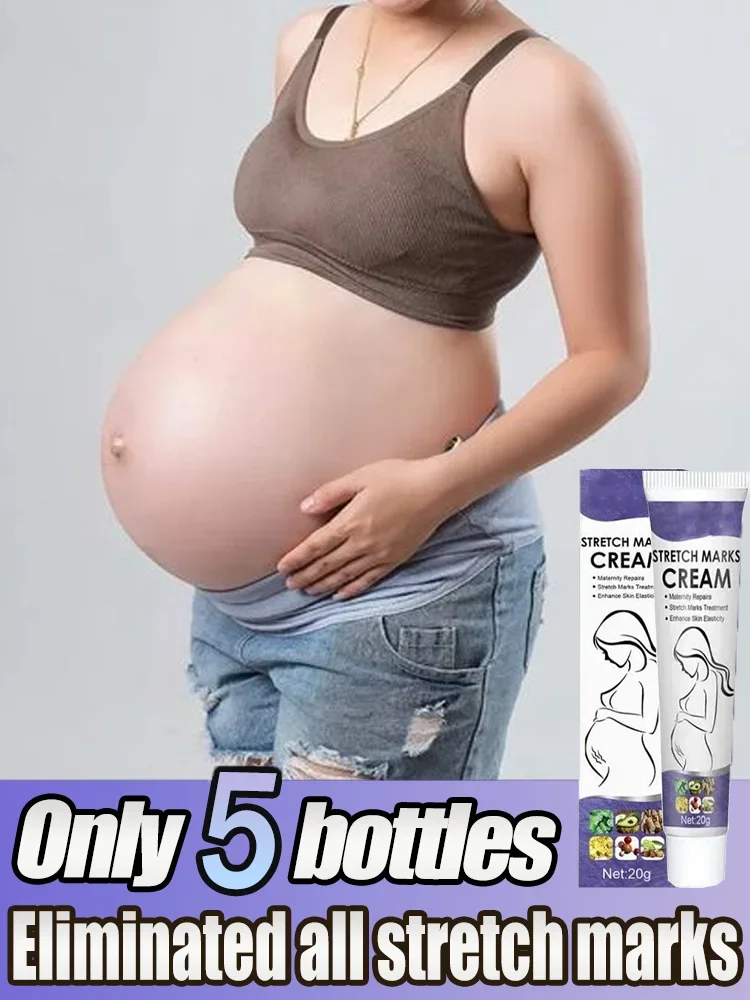 Stretch Marks Repair Essential Oil Skin Care Treatment Cream For Maternity Remover Anti-Wrinkle Slackline For Pregnant
Stretch Marks Repair Essential Oil Skin Care Treatment Cream For Maternity Remover Anti-Wrinkle Slackline For Pregnant