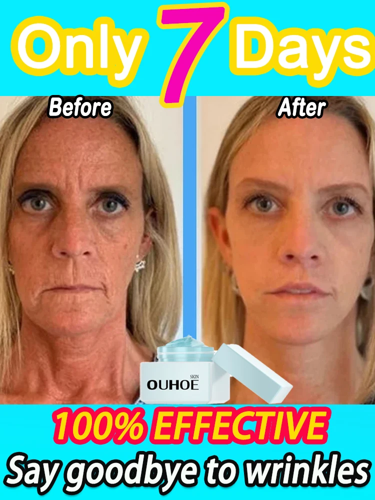 anti-wrinkle oxys cream wrinkles remover abubble skincare korean original skin care products beauty-health whitening face cream
anti-wrinkle oxys cream wrinkles remover abubble skincare korean original skin care products beauty-health whitening face cream