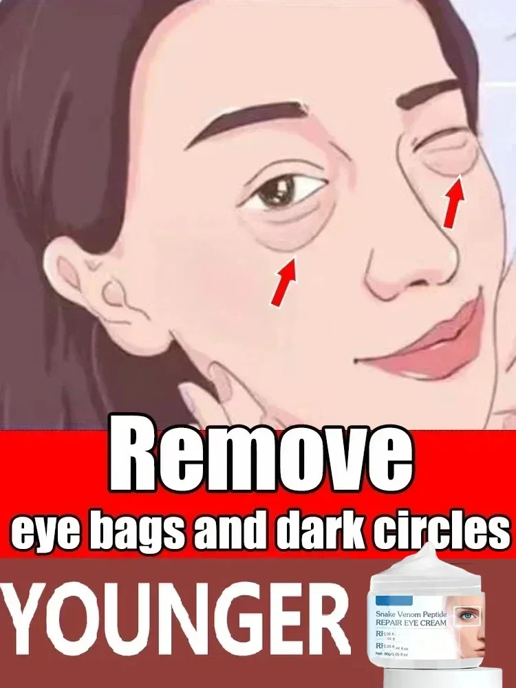 Snake Venom Peptide Repair Eye bags Cream Lifting Tighten Firming Remove Edema Anti Wrinkle Lighten Fine Lines Brighten Orignal
Snake Venom Peptide Repair Eye bags Cream Lifting Tighten Firming Remove Edema Anti Wrinkle Lighten Fine Lines Brighten Orignal