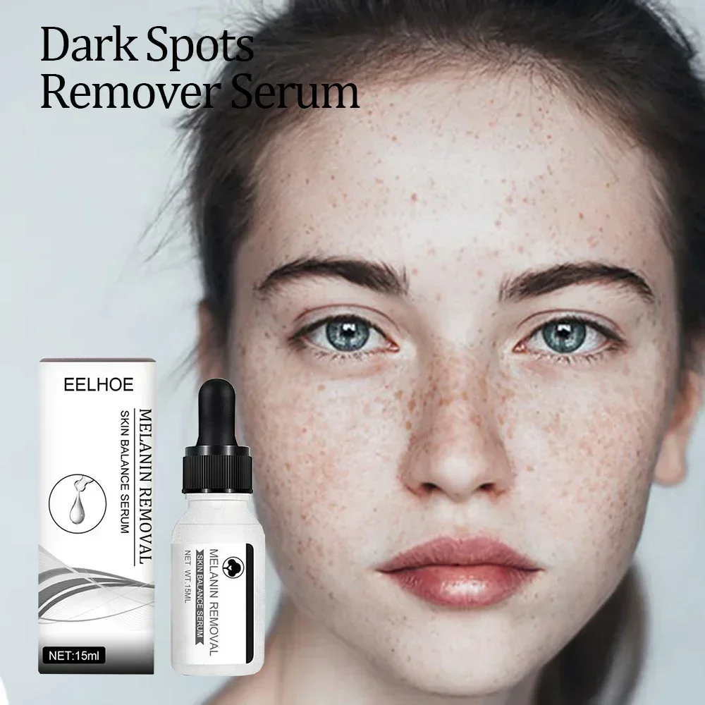 Whitening Lightening Spot Essence To Lighten Chloasma Replenish Water Moisturize Brighten And Beautify Skin Whitening Serum
Whitening Lightening Spot Essence To Lighten Chloasma Replenish Water Moisturize Brighten And Beautify Skin Whitening Serum