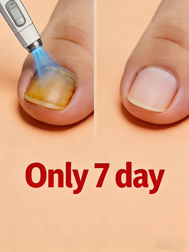 Nail Fungus Laser Treatment Device Repair Toenail Fingernail Fungus Treat Onychomycosis Therapy Cure Machine Effectively Remove
Nail Fungus Laser Treatment Device Repair Toenail Fingernail Fungus Treat Onychomycosis Therapy Cure Machine Effectively Remove