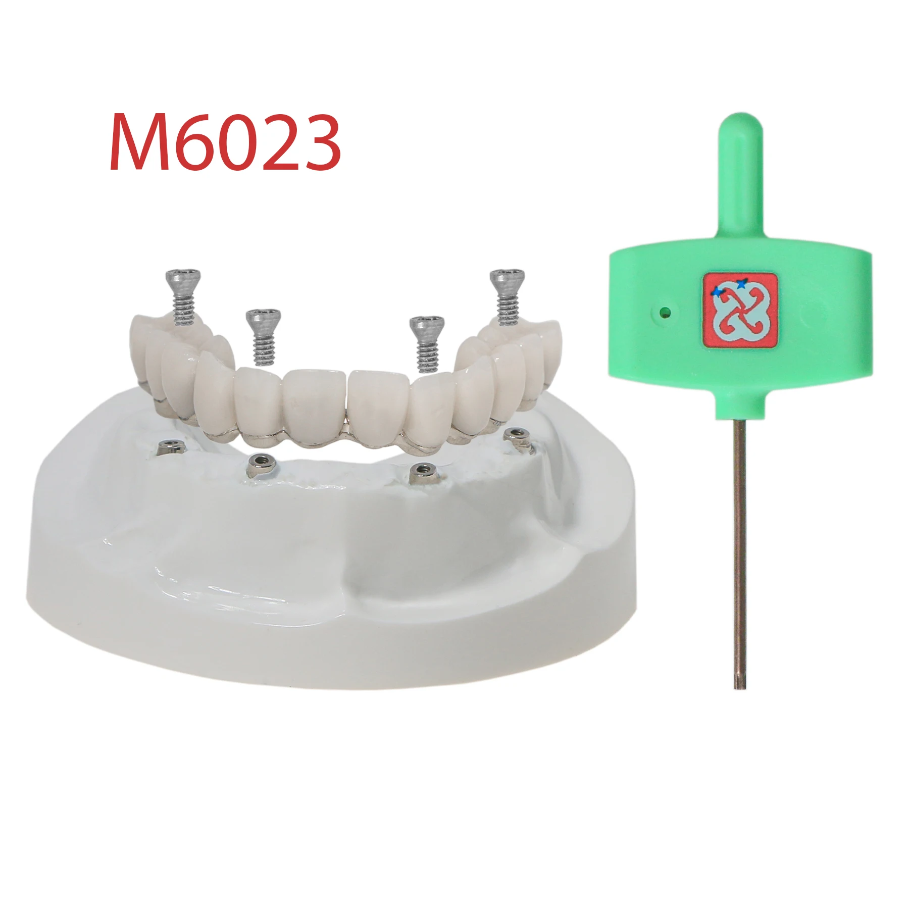 Dental Implant All-on-4 Overdenture Model Upper Jaw Restoration With 4 Screws M6023
Dental Implant All-on-4 Overdenture Model Upper Jaw Restoration With 4 Screws M6023
