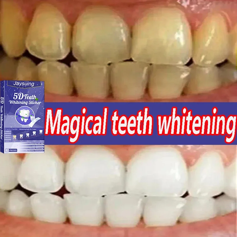 5D Whitening Teeth Stickers Gel Whitening Strips Stain Removal Oral Hygiene Care Strip Dental Bleaching Clean Oral Hygiene Teeth
5D Whitening Teeth Stickers Gel Whitening Strips Stain Removal Oral Hygiene Care Strip Dental Bleaching Clean Oral Hygiene Teeth