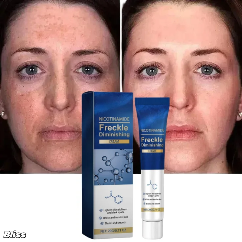 Effective Brightening Face Cream Remove Melasma Dark Spots Fade Pigmentation Bleach Cream Moisturizing Brighten Beauty Skin Care
Effective Brightening Face Cream Remove Melasma Dark Spots Fade Pigmentation Bleach Cream Moisturizing Brighten Beauty Skin Care