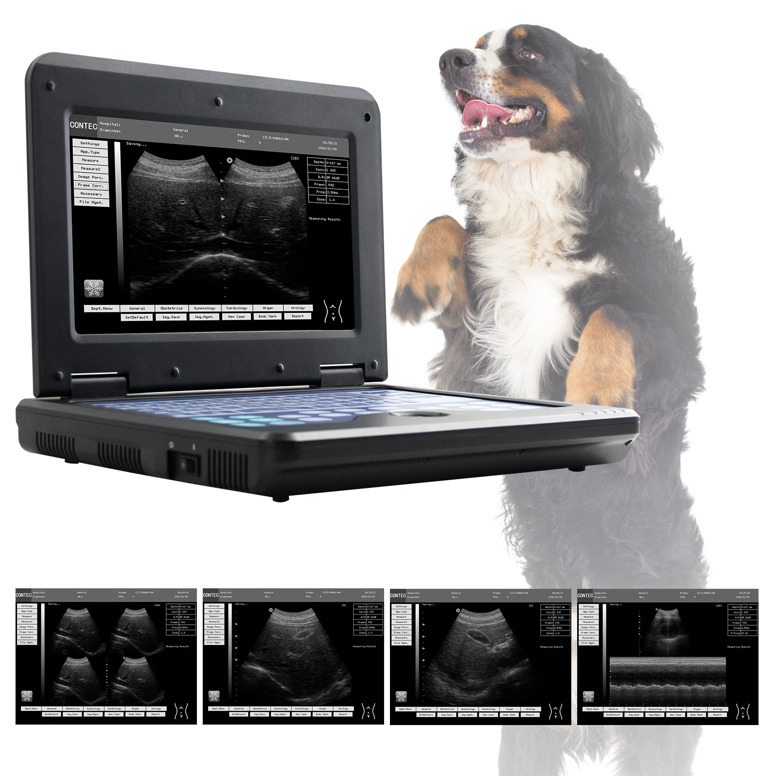 CMS600P2VET Veterinary Equipment Portable Ultrasound Scanner Veterinary Ultrasound Machine
CMS600P2VET Veterinary Equipment Portable Ultrasound Scanner Veterinary Ultrasound Machine