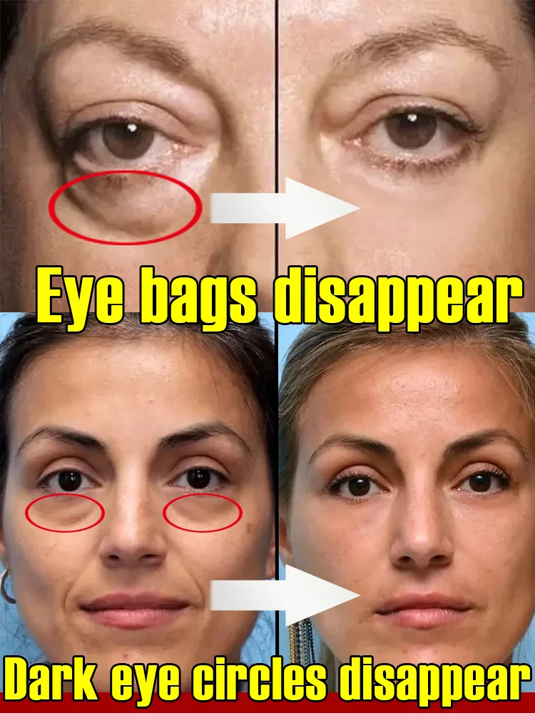 Brightening Concealer Waterproof Sweat Resistant Strongly Covers Spots Eye Facial Acne Marks Dark Circles Woman Face Makeup
Brightening Concealer Waterproof Sweat Resistant Strongly Covers Spots Eye Facial Acne Marks Dark Circles Woman Face Makeup