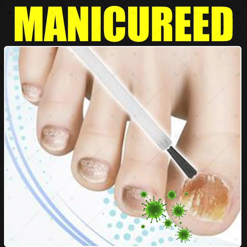 2025 Toenail Fungus Patch Waterproof Nail Repair Patches Nail Ingrown Correction Sticker Discolored Damaged Nail Foot Care Tool
2025 Toenail Fungus Patch Waterproof Nail Repair Patches Nail Ingrown Correction Sticker Discolored Damaged Nail Foot Care Tool