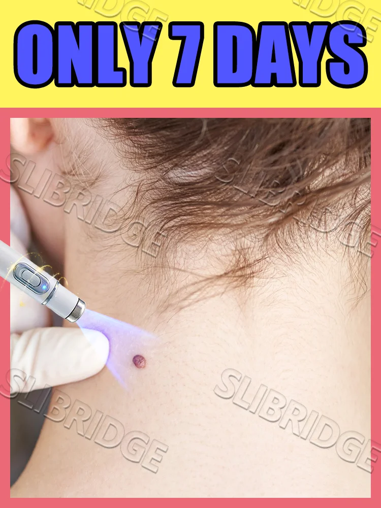 blue light pen solve warts,wart care tools,free shipping
blue light pen solve warts,wart care tools,free shipping