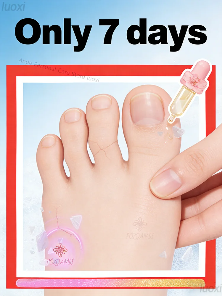 Каждая капля – это естественная лечебная сила и способствует здоровью нового роста ногтей. Растительная формула.
Каждая капля – это естественная лечебная сила и способствует здоровью нового роста ногтей. Растительная формула.