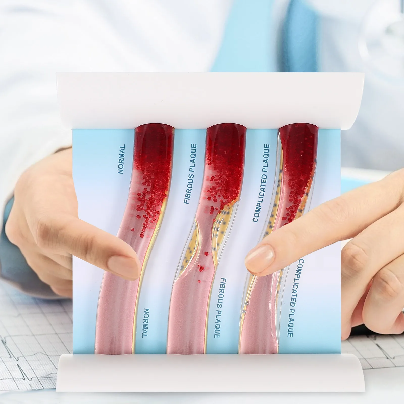 Low-Density Lipoprotein Blood Vessel Anatomical Teaching Aid Cardiovascular Awareness Dynamic Plastic Vascular Educational Tool
Low-Density Lipoprotein Blood Vessel Anatomical Teaching Aid Cardiovascular Awareness Dynamic Plastic Vascular Educational Tool