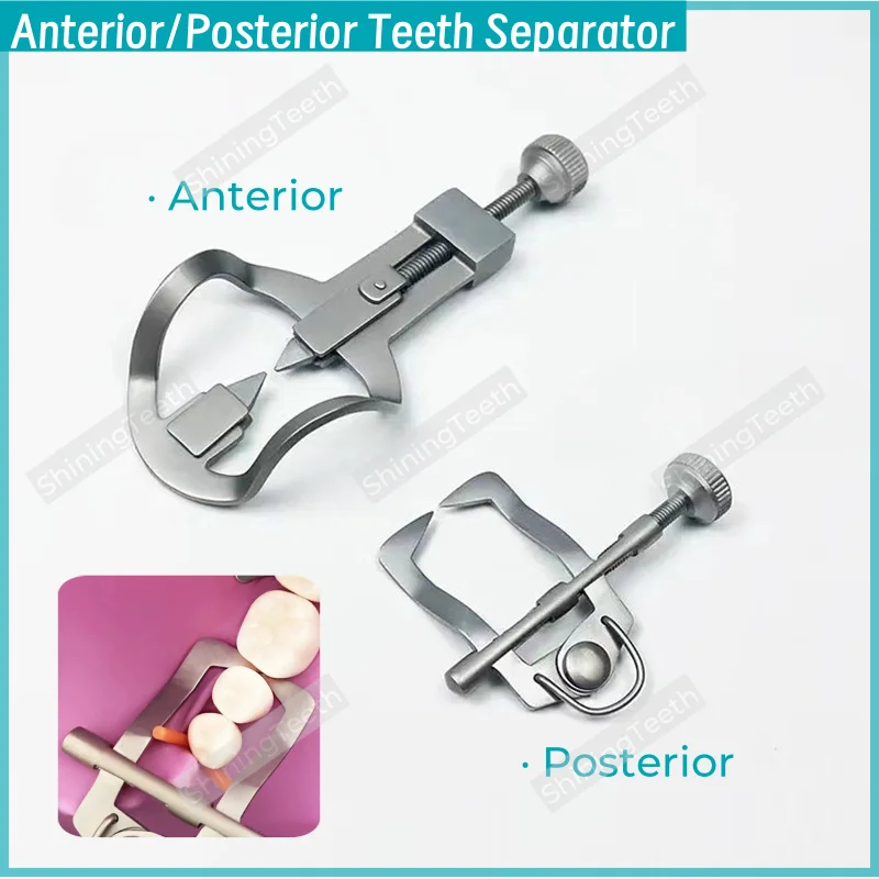 Dental Teeth Separator Kit Orthodontic Tooth Divider Wedges Retainer Anterior Posterior Teeth Rubber Dam Matrix Instrument Tools
Dental Teeth Separator Kit Orthodontic Tooth Divider Wedges Retainer Anterior Posterior Teeth Rubber Dam Matrix Instrument Tools