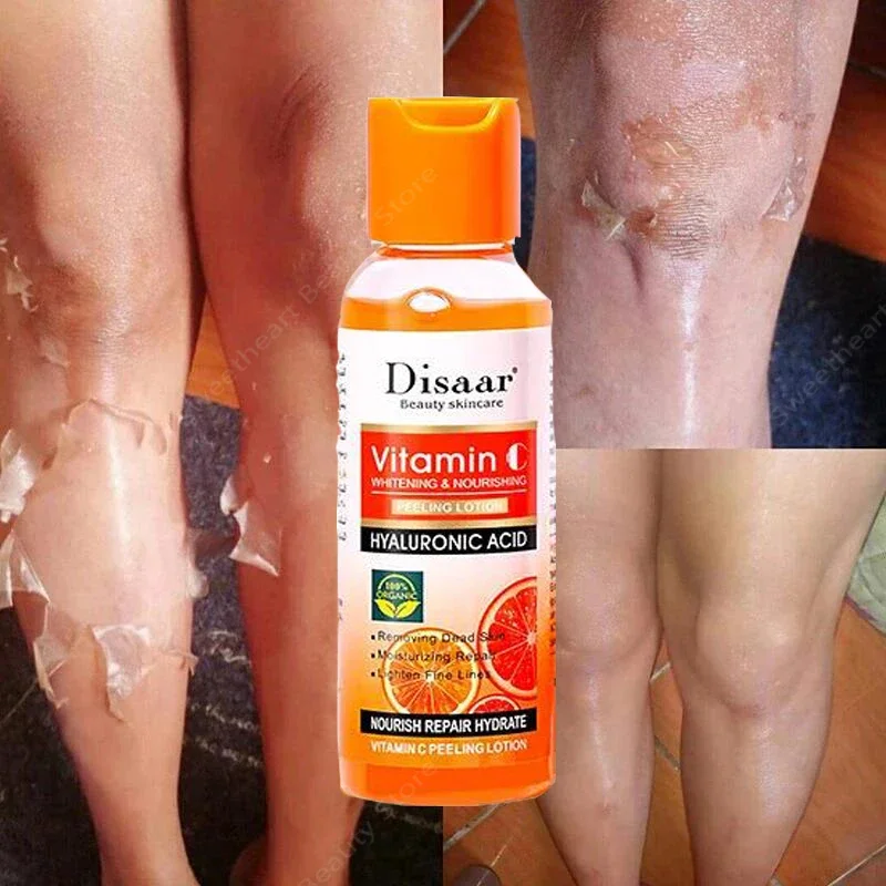 Yellow Peeling Lotion Oil 100% Organic Bleaching Dark Skin Exfoliating Whitening Nourishing Hyaluronic Acid Moisturiz Body Scrub
Yellow Peeling Lotion Oil 100% Organic Bleaching Dark Skin Exfoliating Whitening Nourishing Hyaluronic Acid Moisturiz Body Scrub