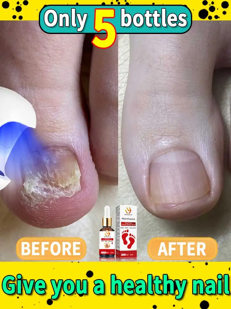 Portable nail cleaning equipment, professional nail laser irradiation, nail accessories
Portable nail cleaning equipment, professional nail laser irradiation, nail accessories