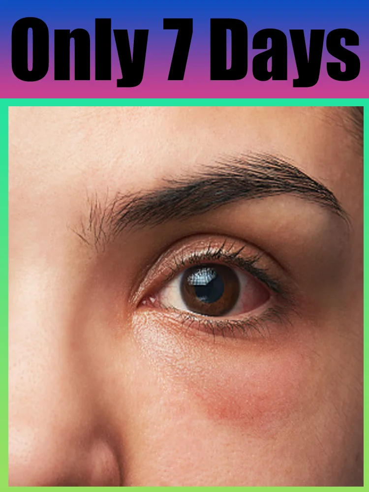 2025 upgraded Eyes Art tool solve suitable for all skin types
2025 upgraded Eyes Art tool solve suitable for all skin types