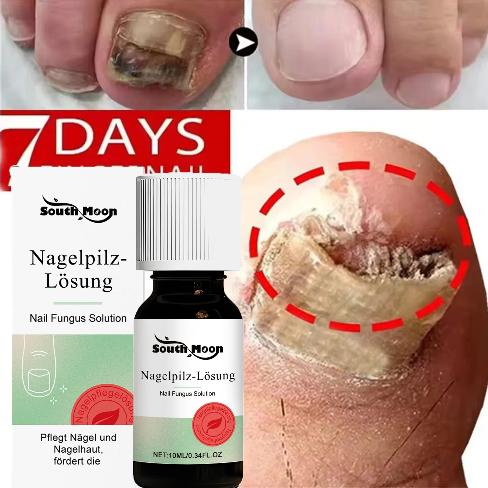 Foot Toe Nail Fungus Removal Essential Oil Nail Fungal Treatment SerumAnti Infection Onychomycosis Paronychia Repairing Care10ml
Foot Toe Nail Fungus Removal Essential Oil Nail Fungal Treatment SerumAnti Infection Onychomycosis Paronychia Repairing Care10ml