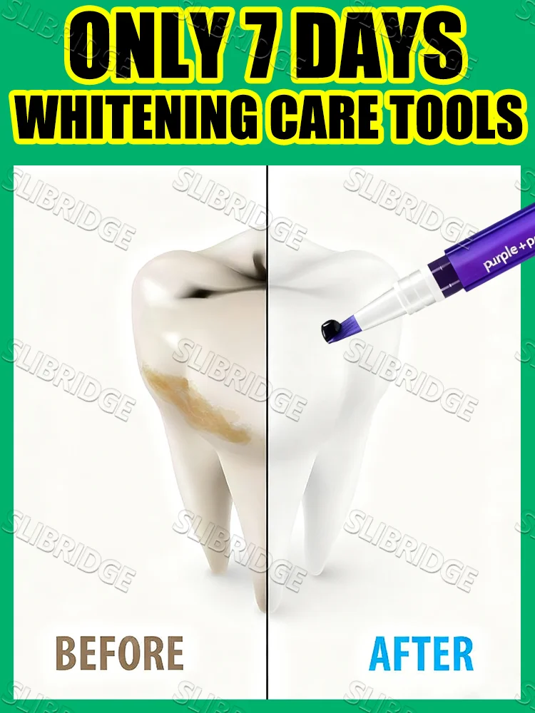 Whitening pen solve yellow stains,Dental whitening care tools,free shipping
Whitening pen solve yellow stains,Dental whitening care tools,free shipping