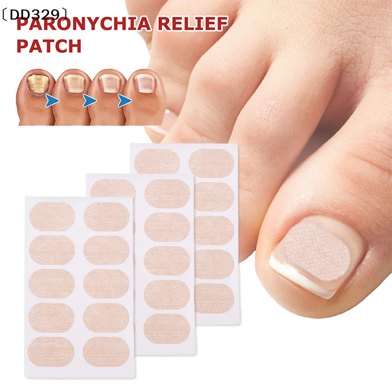 〔DD329〕10pcs Nail Correction Stickers Ingrown Toenail Onychomycosis Repair Patch Paronychia Treatment Corrector Pedicure Tools
〔DD329〕10pcs Nail Correction Stickers Ingrown Toenail Onychomycosis Repair Patch Paronychia Treatment Corrector Pedicure Tools