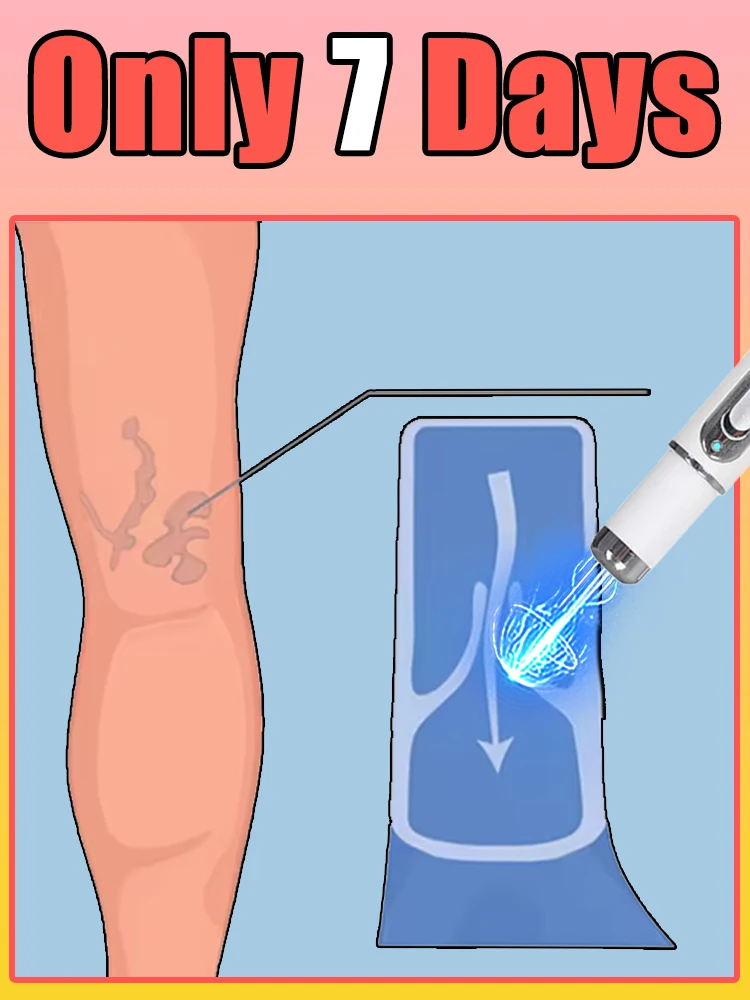 Синяя светящаяся ручка Foot Blue Light Pen 2026
Синяя светящаяся ручка Foot Blue Light Pen 2026