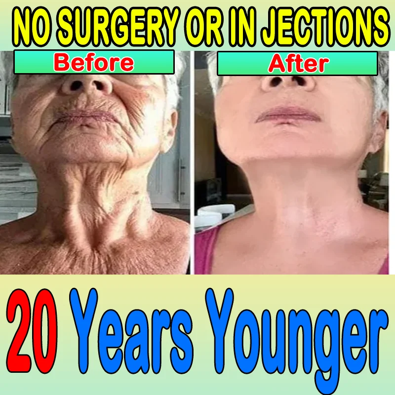 anti-wrinkle oxys cream wrinkle face anti wrinkle cream beauty-health face lift facial massagers lighting cream anti aging crea
anti-wrinkle oxys cream wrinkle face anti wrinkle cream beauty-health face lift facial massagers lighting cream anti aging crea