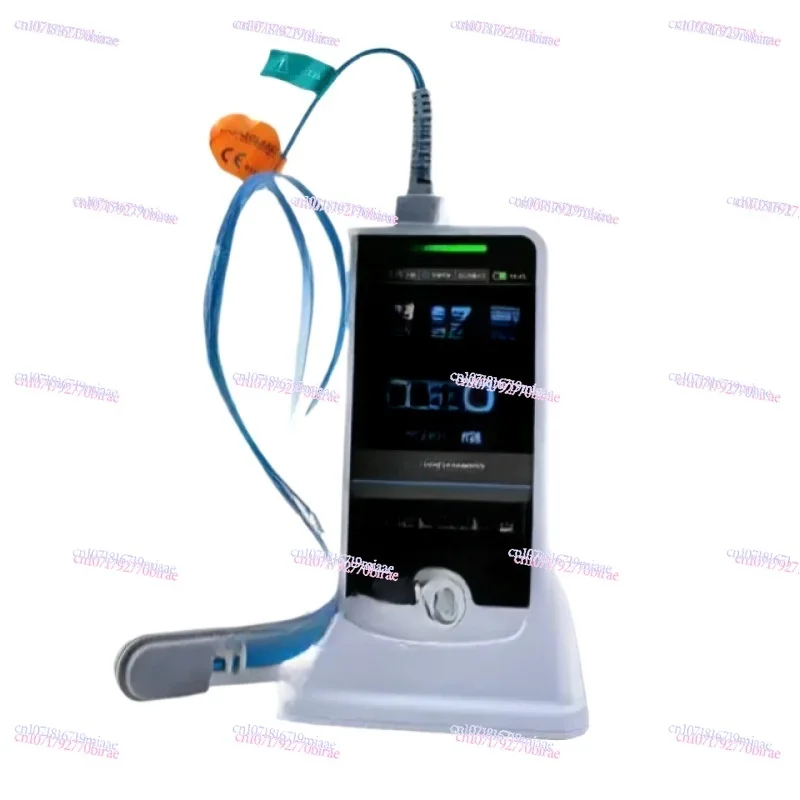 Veterinary vital signs portable pet monitor ECG blood pressure oxygen monitor
Veterinary vital signs portable pet monitor ECG blood pressure oxygen monitor
