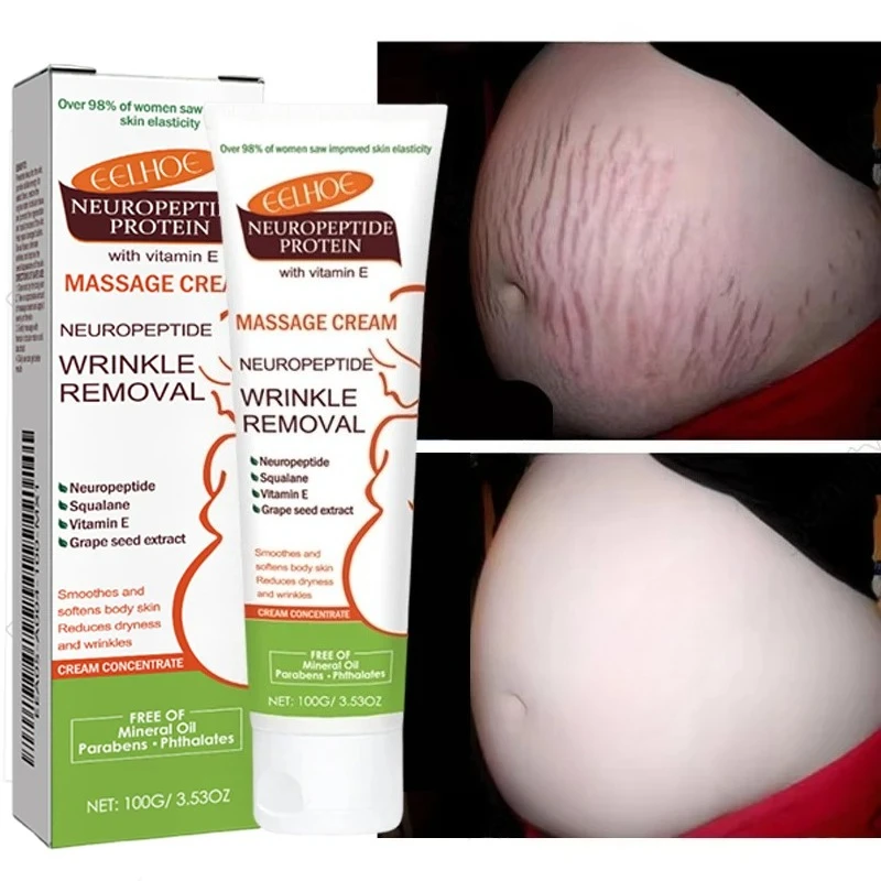 100g Stretch Marks Permanent Removal Cream Maternity Pregnant Women Pregnancy Anti-Winkle Smooth Repair Firming Skin Body Care
100g Stretch Marks Permanent Removal Cream Maternity Pregnant Women Pregnancy Anti-Winkle Smooth Repair Firming Skin Body Care