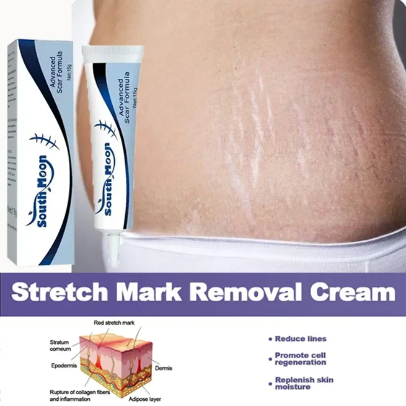 Pregnancy Line Elimination Cream, Removing Old Red and White Line Oil Stretch Mark Repair for Pregnant Women Anti-wrinkle Care
Pregnancy Line Elimination Cream, Removing Old Red and White Line Oil Stretch Mark Repair for Pregnant Women Anti-wrinkle Care