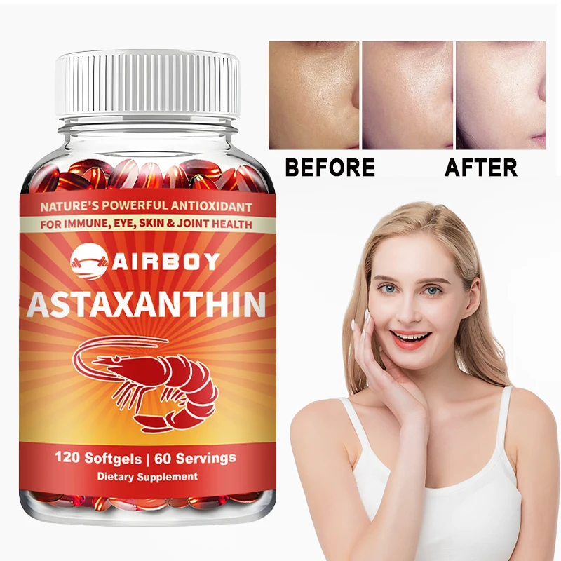 Vegan Astaxanthin with Fish Oil & Antratic Krill Oil, Antioxidant, Supports Eye, Skin, Cellular Health, Non-GMO Capsules
Vegan Astaxanthin with Fish Oil & Antratic Krill Oil, Antioxidant, Supports Eye, Skin, Cellular Health, Non-GMO Capsules