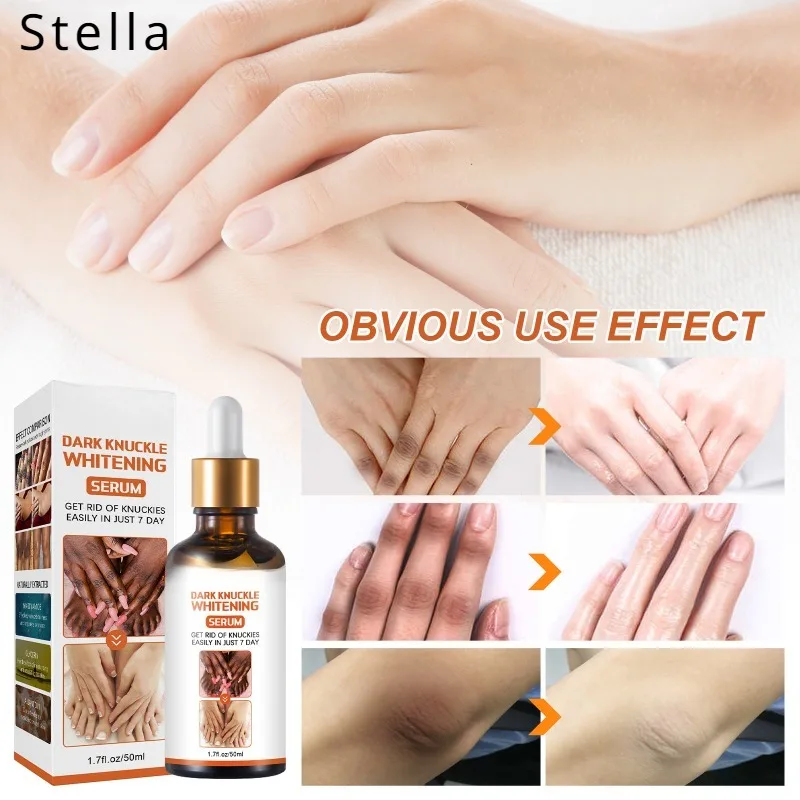 Body Nicotinamide Lightening Cream Brighten Skin Tone Corrector Melanin Moisturizing Intense Stains Remover Products Beauty Care
Body Nicotinamide Lightening Cream Brighten Skin Tone Corrector Melanin Moisturizing Intense Stains Remover Products Beauty Care