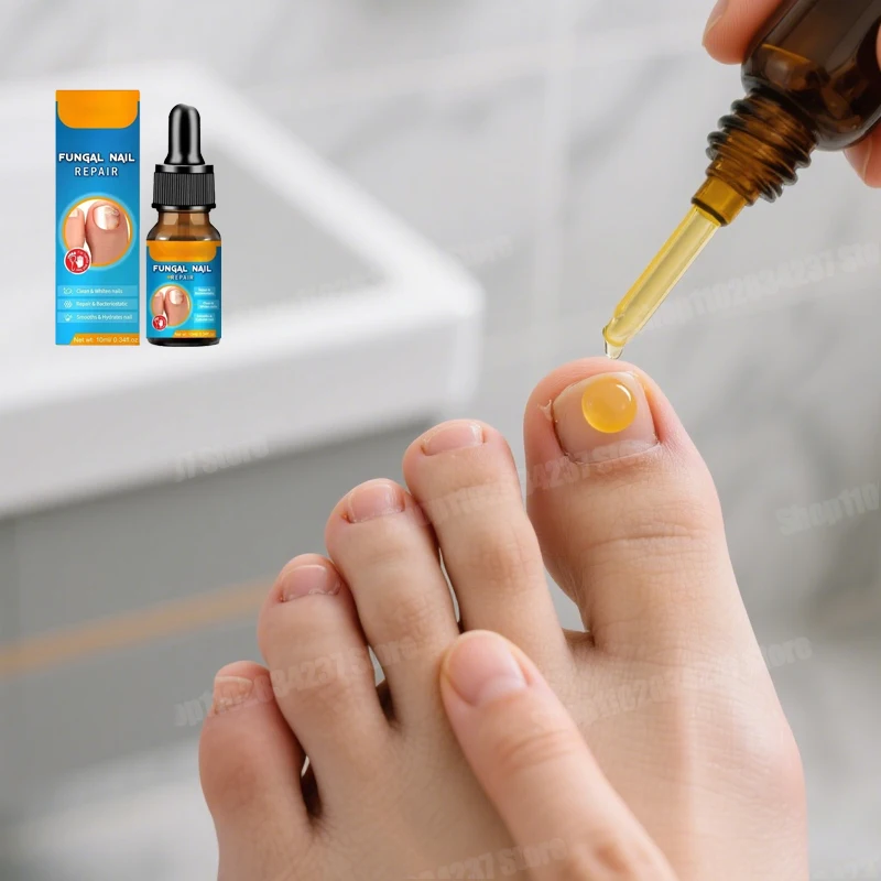 Fungus Removal Nail Repair Serum - Healthy Nails Restoration & Brightening
Fungus Removal Nail Repair Serum - Healthy Nails Restoration & Brightening
