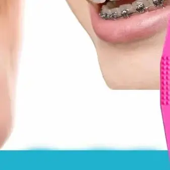 100 шт., ортодонтические эластичные резинки, крючок для брекетов, разные цвета, стоматологические ортодонтические инструменты, набор аксессуаров 
100 шт., ортодонтические эластичные резинки, крючок для брекетов, разные цвета, стоматологические ортодонтические инструменты, набор аксессуаров