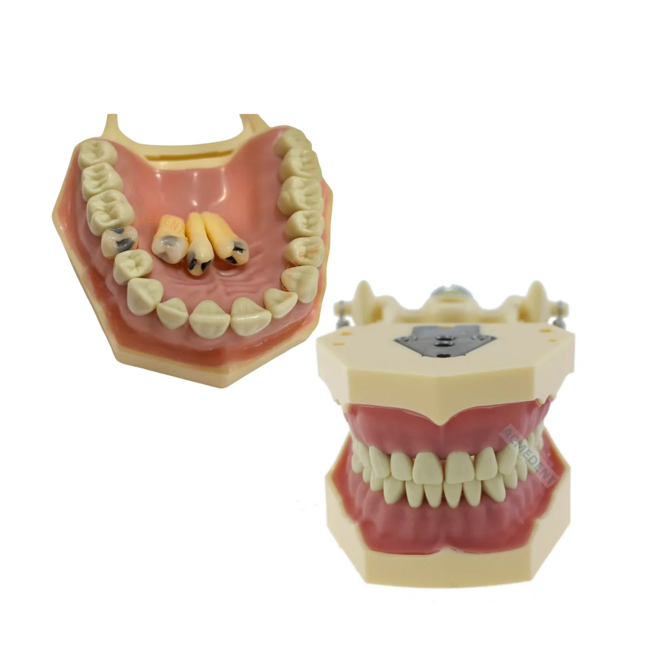 Dental Frasaco AG3 Caires Model Typodont Replacement Decay Removable Teeth AG-3 Training Course
Dental Frasaco AG3 Caires Model Typodont Replacement Decay Removable Teeth AG-3 Training Course