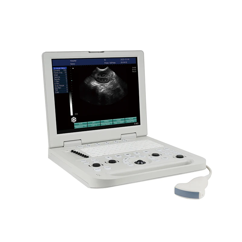 Ultrasonic Diagnostic Imaging System For Pigs Ultrasonic Detector For Veterinary Use Portable Computer B-ultrasound Machine
Ultrasonic Diagnostic Imaging System For Pigs Ultrasonic Detector For Veterinary Use Portable Computer B-ultrasound Machine