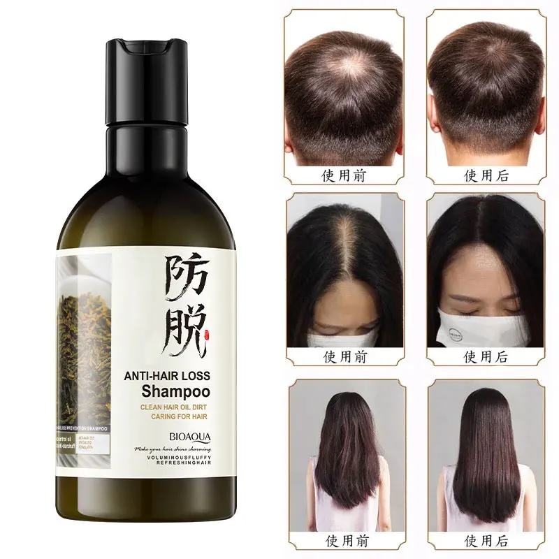 250ml Hair Care Product Ginger Anti Hair Loss Hair Growth Serum Shampoo Effective Loss Treatment
250ml Hair Care Product Ginger Anti Hair Loss Hair Growth Serum Shampoo Effective Loss Treatment
