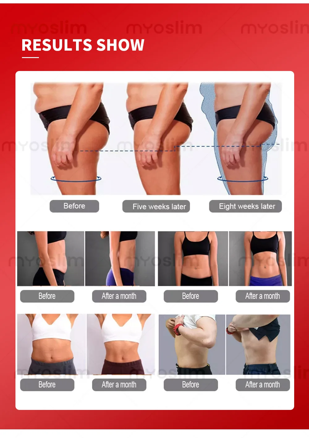 Аппарат для коррекции фигуры MYOSLIM EMS, 6500 Вт, 200 Гц, с функцией радиочастотной стимуляции мышц (RF)
Аппарат для коррекции фигуры MYOSLIM EMS, 6500 Вт, 200 Гц, с функцией радиочастотной стимуляции мышц (RF)